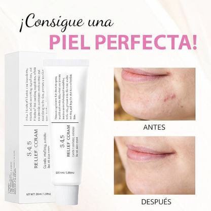 Crema para el acne  ™ Dr Althea 345